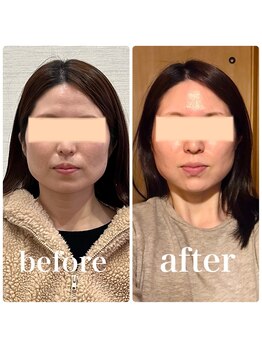 クリーム 京都店(Cream)/