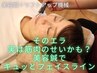 そのエラ実は筋肉のせいかも？美容鍼でキュッとフェイスライン！鍼＋EMS機械
