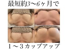 エスビューティー 三軒茶屋(S beauty)の雰囲気（デコルテのボリュームアップアップしながら、全身痩せが出来る♪）
