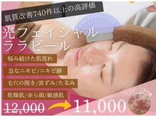 チャパン(Chapan)