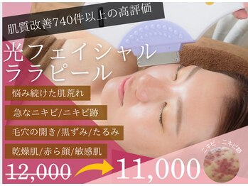 チャパン(Chapan)