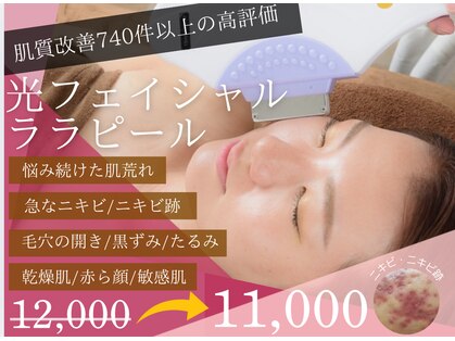 チャパン(Chapan)の写真