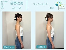 ボディコンディション/ウィンバック/痩身/小顔ラジオ波