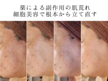 ユウビジン(YOU美人)/