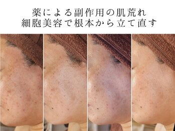 ユウビジン(YOU美人)/