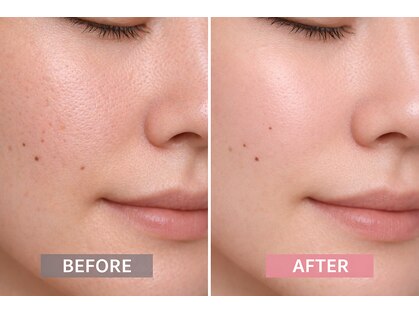 サロン リノ(salon rino)の写真