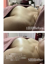 チュラ 大宮店(Chura)/【50代】バストアップ5回目@大宮