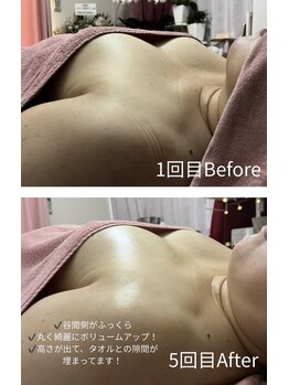 チュラ 大宮店(Chura)/【50代】バストアップ5回目@大宮