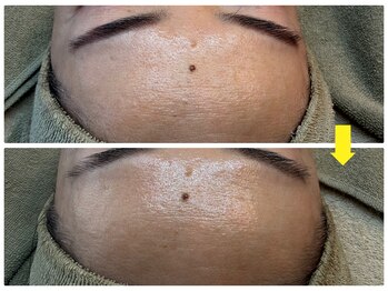 アルマ(ALMA)/額、意外とお手入れできてる？