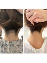 ミース 自由が丘店/うなじ矯正◆ビフォーアフター