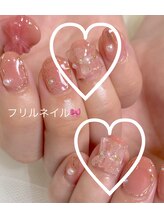 イマドキ(IMADOKI)/フリルネイル☆