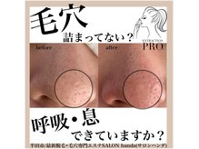 サロン 半田店(SALON)の雰囲気（話題の【毛穴エステ】であなたの毛穴悩みを解決◎）