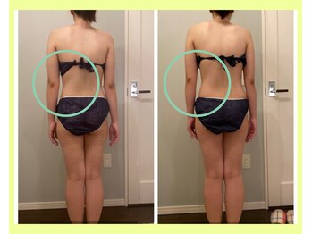 ヨサパーク コクリ(YOSA PARK kokuRi)/痩身/ダイエット/リンパ/産後