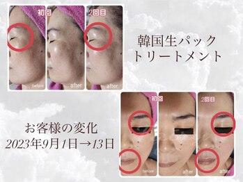 フェアリー(Fairy)