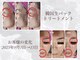 フェアリー(Fairy)の写真