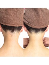 エキュロ 敦賀店(equro)/うなじのデザイン