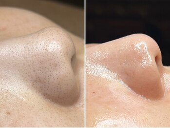 アイスリー(i III)