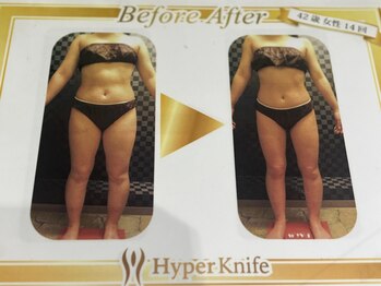 ビューティーボディー 小岩(Beauty Body)/42歳14回変化