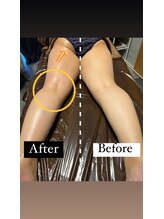 リーリア(LiLia)/こんなにすぐ変わる♪