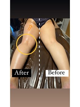 リーリア(LiLia)/こんなにすぐ変わる♪