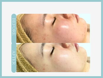 スリムライン 盛岡店(The Slim Line)/before→after