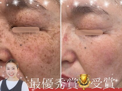 ハウオリ(HAUOLI)の写真