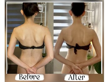 ソウ バイ ソウ(So by 蒼)/肋骨と肩甲骨は、密接な関係が。