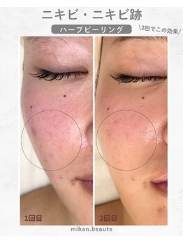 ミハン ボーテ(mihan.beaute)/