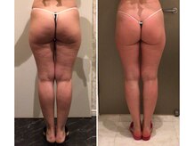 プライマルビューティ 艶 本店(Primal Beauty)/WINBACK　ビフォーアフター