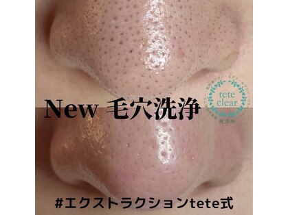 ミラーヴ(MERAVE)の写真