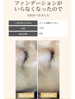毛穴専科/シミケアでノーファンデ生活!