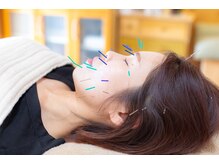 ハリルナ(hari.luna)/美容鍼