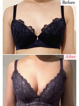 ラビス(RAVIS)/20代☆F→Gカップ