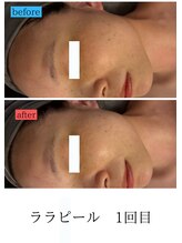 ユフラ(Juhla)/ララピール