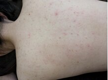 リデザイン 京都(REDESIGN)/REDESIGN京都中医施術法