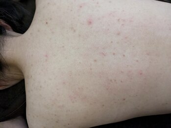 リデザイン 京都(REDESIGN)/REDESIGN京都中医施術法