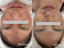 イーサロン(eii salon)/40代女性