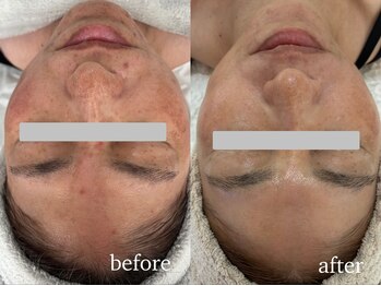 イーサロン(eii salon)/40代女性