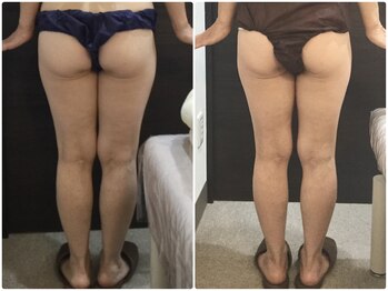 美容整体ウェリナ 名駅院/小顔矯正/骨盤矯正/美脚サロン