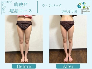 ボディコンディション/ウィンバック/痩身/小顔毛穴洗浄