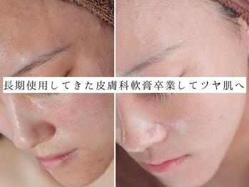 ユウビジン(YOU美人)/