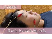 ユーフォリア(Euphoria)/美容鍼灸