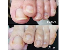 リゼラアンドコー 盛岡店の雰囲気（足の爪が切れない、爪をキレイにしたい！爪コースがおススメです）