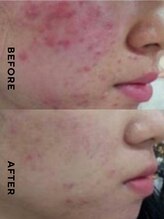 ココ ル メアリー アシヤ(COCO LE MARY ASHIYA)/Befor After