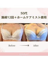 ミミバスト(mimibust)/バストアップBeforeAfter