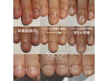 ニコプラス(NICO+)/パラジェルクリア補強