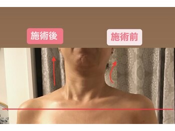 クレーアインス(kleeins)/半身コース☆