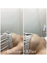 セカンドフロア バイ ブレスト ハコダテ(2nd floor by BLESSED HKD)/バストケアでハリUP