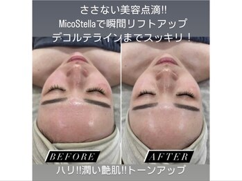 煌(kirameki)/肌改善コース