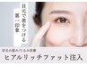 【目元の窪み/たるみ改善】エステで叶う脂肪増殖★ヒアルリッチ注入